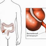 appendix