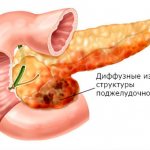 Diffuse changes in the pancreatic parenchyma usually indicate replacement of glandular tissue with scars or fat cells