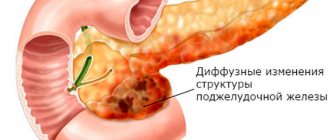 Diffuse changes in the pancreatic parenchyma usually indicate replacement of glandular tissue with scars or fat cells