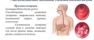 Gastroscopy