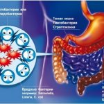 What causes frequent diarrhea in adults and how to treat it