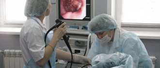 How is esophageal manometry done?