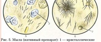 Как выглядит появление жирных кислот в каловой массе