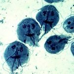 What Giardia looks like