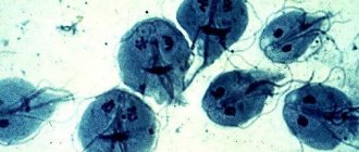 What Giardia looks like