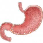 Pathology erosive gastritis