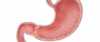 Pathology erosive gastritis