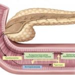 Diarrhea with pancreatitis (diarrhea): treatment, how to stop, herbal medicine