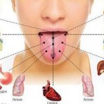 A sign of which disease is a white coating on the tongue. Possible diseases 