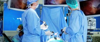 Carrying out laparoscopy