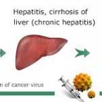 Development of the disease in humans