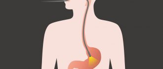 Scheme of gastroscopy