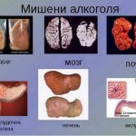 Восстановление организма после отказа от алкоголя. Поэтапное ...