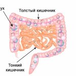 Bloating, gas formation in the intestines