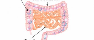 Bloating, gas formation in the intestines