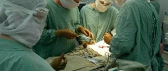 Closing the colostomy during the operation. Colostomy surgery 